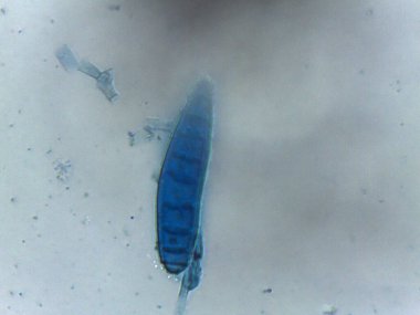 Lactophenol mavisi bir kalıbın çoklu septik üreme sporlarını vurgular..