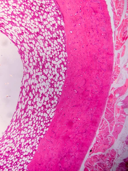 Dokuları Bağlayıcı ve Kas Katmanlarıyla Adialize Et