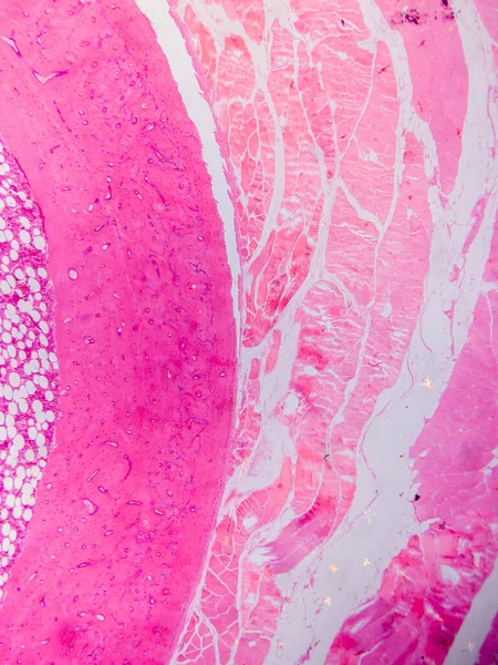 Dokuları Bağlayıcı ve Kas Katmanlarıyla Adialize Et