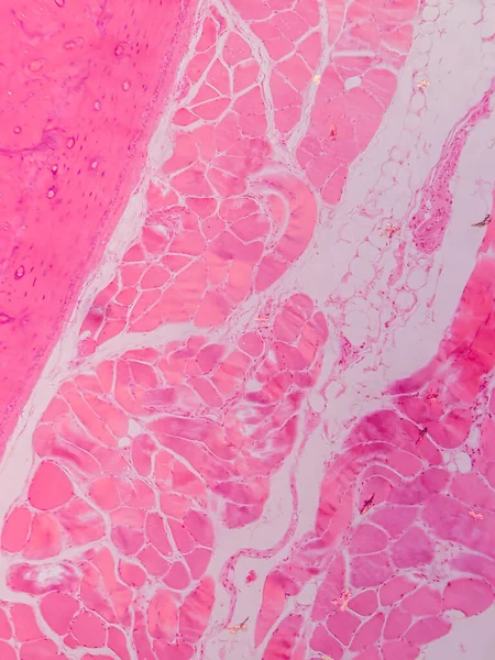 Dokuları Bağlayıcı ve Kas Katmanlarıyla Adialize Et