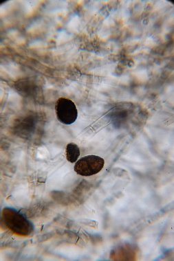 Açık Islak Dağ Örneklerindeki Koyu Pembeli Mantar Konidia ve Hyphal Yapılarının Mikroskobik Görselleştirmesi.