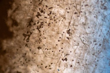 Çok hücreli dematiasyonel mantar sporlarının enine boyuna Sepsiyon sergilendiğini gösteren yüksek güçlü fotomikrograf.