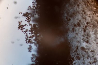 Çok hücreli dematiasyonel mantar sporlarının enine boyuna Sepsiyon sergilendiğini gösteren yüksek güçlü fotomikrograf.