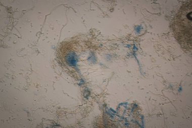 Mikroskobik Yaşam Ağı: Çürümüş Organik Bataklık Örnekte Hipokrat İpliklerinin Karışıklıklarını Gözlemlemek