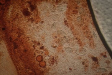 Çürüme Örnekleri, Mantar Sporları, Mikrobik Enkaz ve Protozoan Yaşam Biçimlerinin Mikroskobik Alan Görünümü