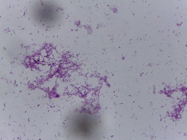 Karışık Bakteri Türleri ve İlkel Omurgalı Anatomisi Mikroskobik Çalışmaları