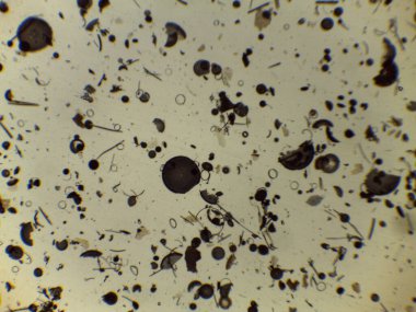 Microscopic Collection of Various Diatom Silica Shells and Biological Specimen Slides