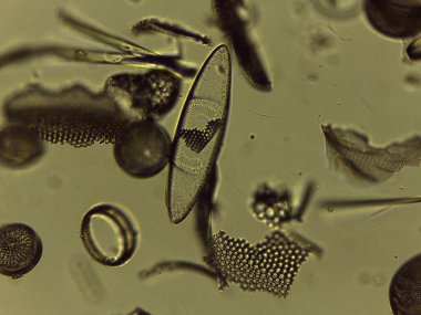 Microscopic Collection of Various Diatom Silica Shells and Biological Specimen Slides