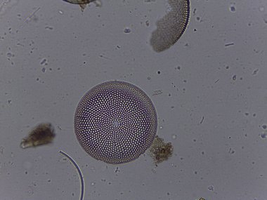 Diatomlar ve İlkel Koordinatlar dahil çeşitli biyolojik örneklerin mikroskobik Atlası