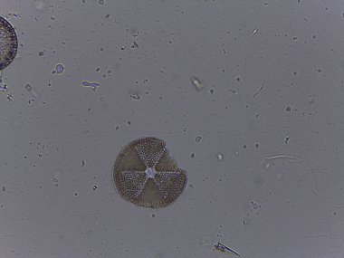 Diatomlar ve İlkel Koordinatlar dahil çeşitli biyolojik örneklerin mikroskobik Atlası