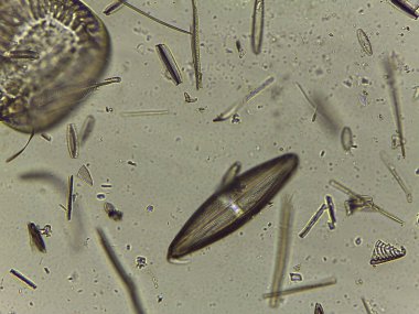 Süslü Diatom Meyveleri ve Su Mikroorganizmaları Yüksek Çözünürlüklü Mikroskobik Çalışması