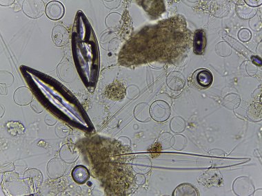Diatomlar ve İlkel Koordinatlar dahil çeşitli biyolojik örneklerin mikroskobik Atlası