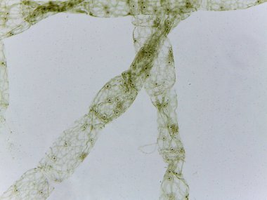 Oedogonium Nanandrisch Alglerinin Mikroskobik Görselleştirilmesi ve Uzmanlaşmış Üreme Anatomisi