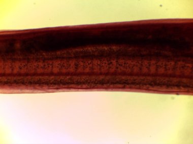 Ammocoetes Larva ve Köpek Balığı Placoid Pulları Mikroskobik Anatomisi