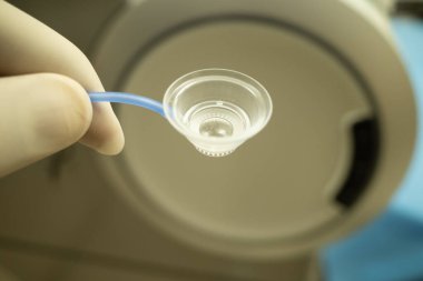 SMILE ve Femto-LASIK Görme Düzeltme İşlemleri İçin Saydam Tıbbi Hasta Arayüzü Tutan Profesyonel Oftalmik Cerrah