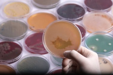 Arka planda çeşitli petri kaplarıyla çevrili bakteri kültürü olan bir petri kabını tutan bir el.