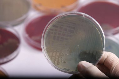 Arka planda çeşitli petri kaplarıyla çevrili bakteriyel kültürlerle dolu bir petri kabı tutan bir kişi.