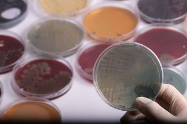Farklı renk ve içeriklere sahip çeşitli petri kablarıyla çevrili bakteri kültürleriyle dolu bir petri kabını tutan bir el.
