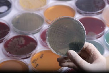 Arka planda çeşitli renkli petri kaplarıyla çevrili yeşilimsi bir kültüre sahip petri kabını tutan bir el.