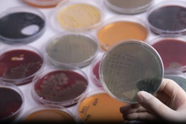 Mikrobiyolojik araştırmalar için kullanılan arka planda çeşitli renkli tarım tabakaları olan petri kabını tutan bir el.