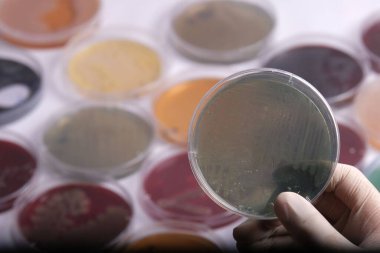 Arka planda çeşitli renkli petri kaplarıyla çevrili temiz bir ortamla petri kabını tutan bir el mikrobiyoloji deneyleri sergiliyor.