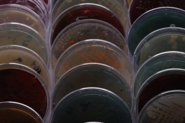 Çeşitli kültürleri içeren, farklı renkler ve mikrobik büyüme dokularını gösteren birden fazla petri kabının yakın plan görüntüsü