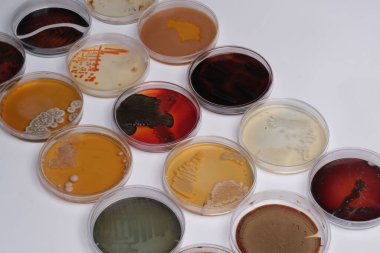 Farklı kültürler içeren çeşitli petri kapları, mikrobiyoloji ve laboratuvar ortamlarında kullanılan çeşitli renk ve dokuları sergiliyor.