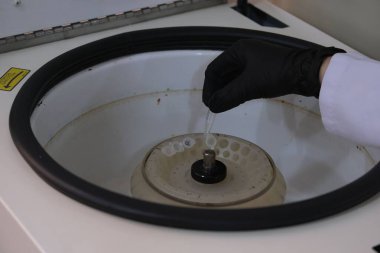 Sıvıyı santrifüje aktarmak için pipet kullanan bir laboratuvar teknisyeni.