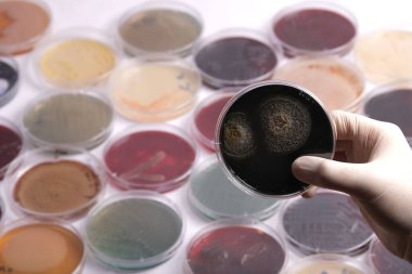 Farklı kültürleri barındıran çeşitli petri kaplarıyla çevrili bir petri kabını tutan bir el.