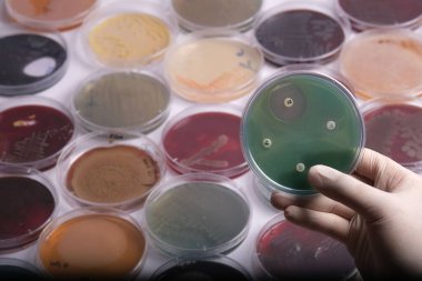 Bir laboratuvar teknisyeni elinde yeşil agarlı bir petri kabı tutuyor, arka planda çeşitli renkli petri kaplarıyla çevrili, mikrobik kültürler sergiliyor.