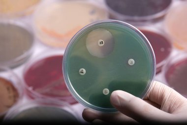 Bakteri kültürü olan bir petri kabını tutan bir el. Arka planda bulanık petri kapları bulunan antibiyotik duyarlılık testini gösteren birkaç küçük disk.