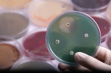 Arka planda çeşitli petri kaplarıyla çevrili bakteri kültürleriyle dolu bir petri kabını tutan bir bilim adamı mikrobiyolojik araştırmaları sergiliyor.