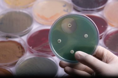 Arka planda birden fazla petri kabıyla çevrili bakteri kültürleriyle dolu bir petri kabını tutan bir bilim adamı, çeşitli renkler ve dokular sergiliyor.