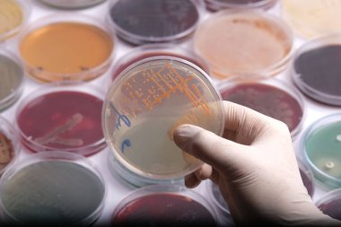 Arka planda çeşitli petri kaplarıyla çevrili bakteri kültürleriyle dolu bir petri kabını tutan bir bilim adamı, farklı renkler ve büyüme şekilleri sergiliyor.