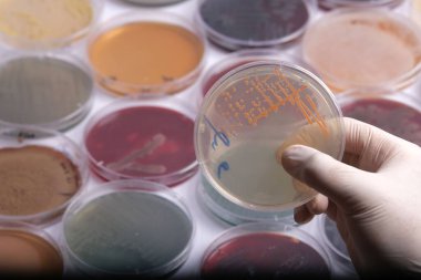 Bir bilim adamı, laboratuvar ortamında çeşitli petri kaplarıyla çevrili bakteriyel kültürlerle dolu bir petri kabını tutuyor.