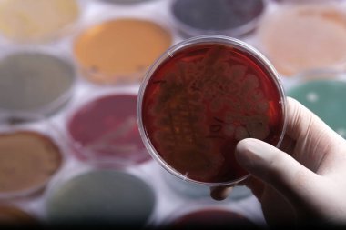 Bir bilim adamı, arka planda çeşitli petri kapları bulunan bir laboratuvar ortamında mikrobiyal büyüme gösteren kırmızı agarlı bir petri kabını tutuyor.