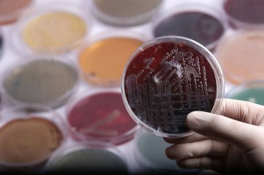 Elinde siyah ve kırmızı bakteri kültürü olan bir petri kabı tutan bir bilimadamı, arka planda çeşitli renkli petri kaplarıyla çevrili.