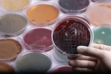 Bir bilim adamı, farklı renk ve içeriklere sahip çeşitli petri kaplarıyla çevrili bakteriyel kültürlerle dolu bir petri kabı tutuyor.