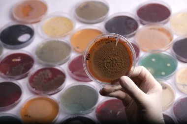 Farklı renkli kültürler ve laboratuvar ortamlarından oluşan çeşitli petri kaplarıyla çevrili kahverengi küf dolu bir petri kabını elinde tutan bir bilim adamı.