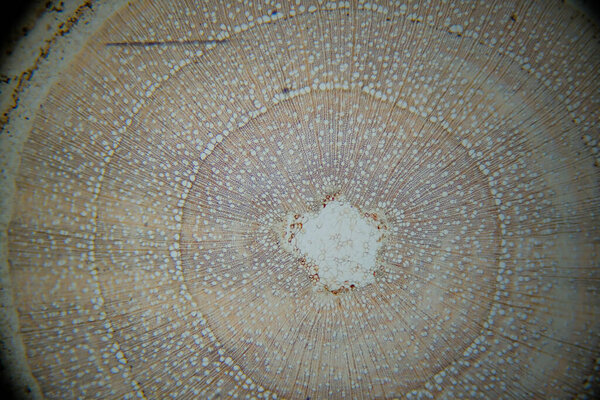 photo of a plant tissue under the microscope