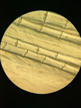 Teleost Balığındaki Parçalanmış Lepidotrichia Kemikli Fin Rays 'in Mikroskobik Görünümü