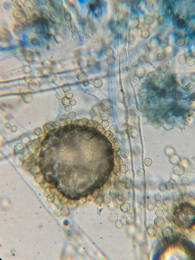 Küresel Mantar Sporları ve Hyphae Yapılarının Ayrıntılı Mikroskobik Görünümü