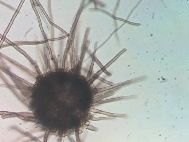 Uzun Tüylü Mantar Perithecia Mikroskobik Görünümü