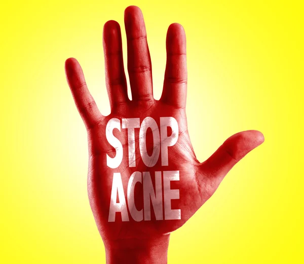 Pare Acne escrito na mão — Fotografia de Stock