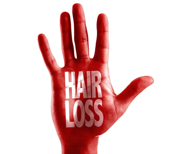 Απώλεια μαλλιών, γραμμένο από πλευρά — Φωτογραφία Αρχείου