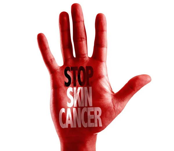 Zatrzymać raka skóry, napisany pod ręką — Zdjęcie stockowe