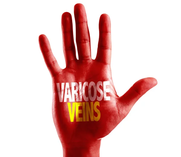 Vene varicose scritte a mano — Foto Stock