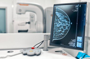 Arka planda mammografi testi yapılan bir kadın hastanın göğüslerinin görüntüsü monitörde. Hastanede mammografi testi. Tıbbi ekipman.