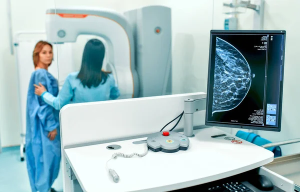 Mammogram Ögonblicksbild Bröst Kvinnlig Patient Skärmen Med Genomgår Mammografi Test — Stockfoto