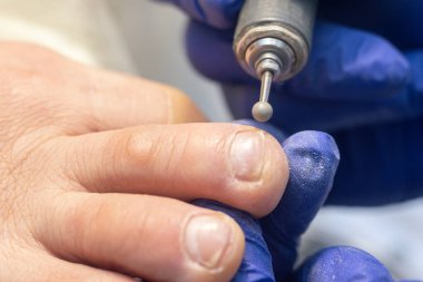 Donanım pedikürü, ayak parmaklarından eski derinin alınması..